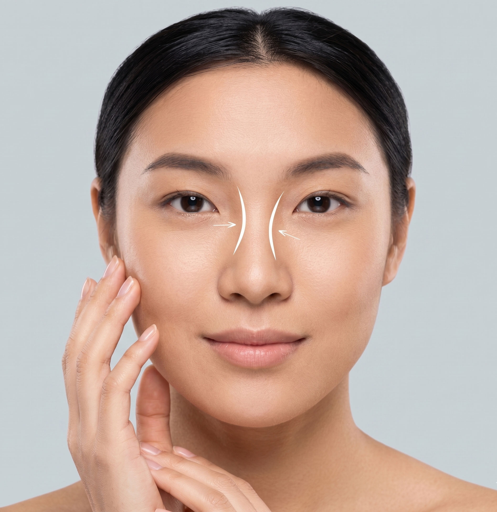 rhinoplasty